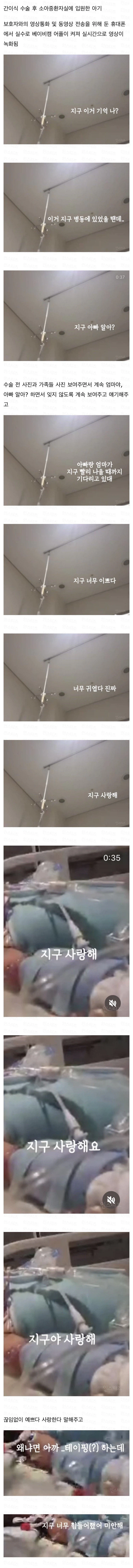 실수로 유출된 소아중환자실 영상