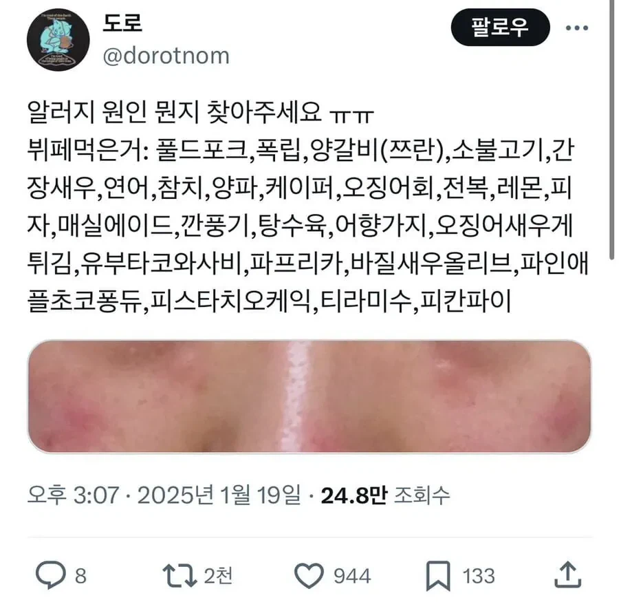 알러지 원인 좀 찾아주세요ㅠㅠㅠ_1.webp
