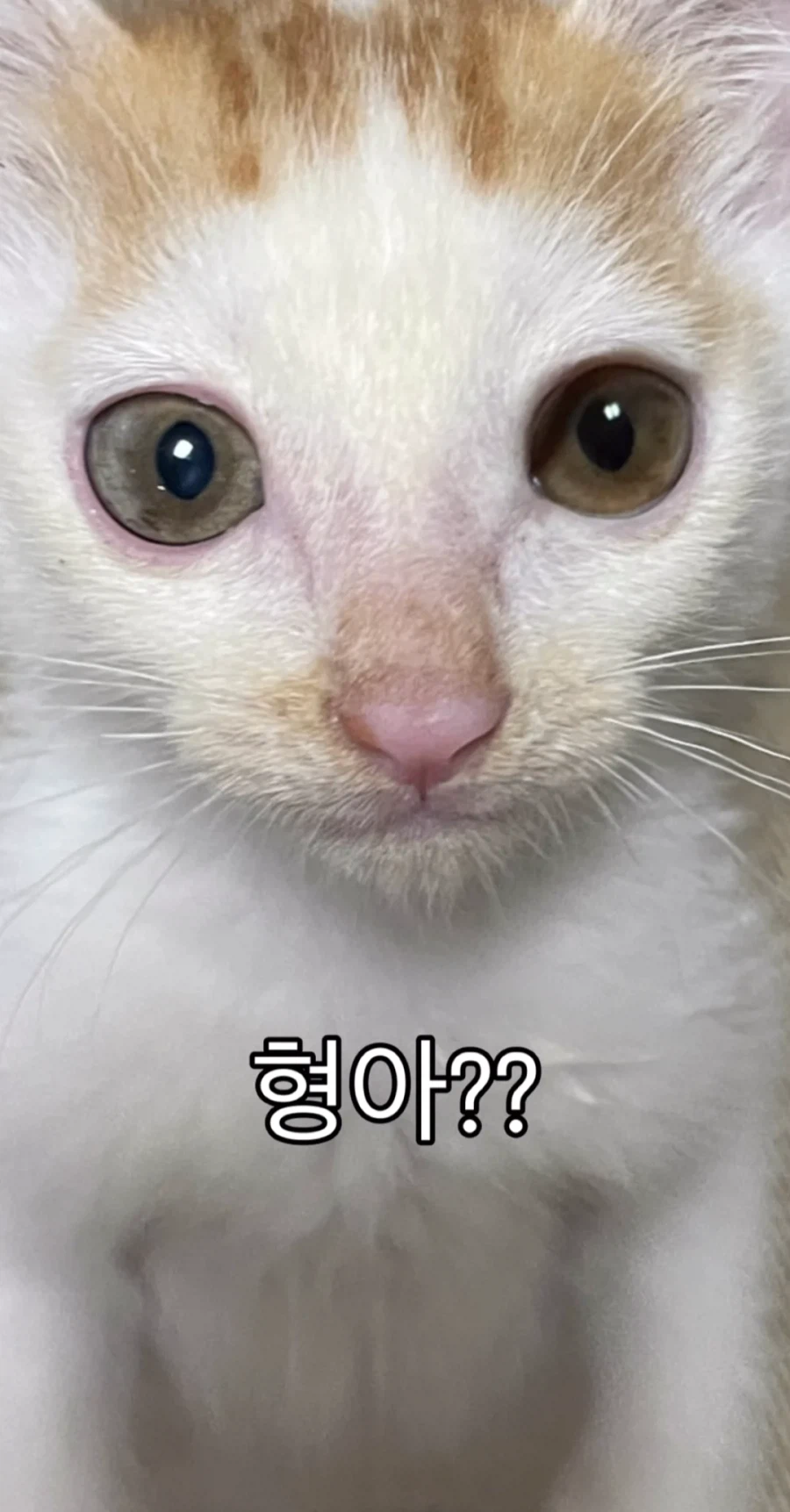 눈을 기증 받게된 애꾸 동생.jpg_7.webp