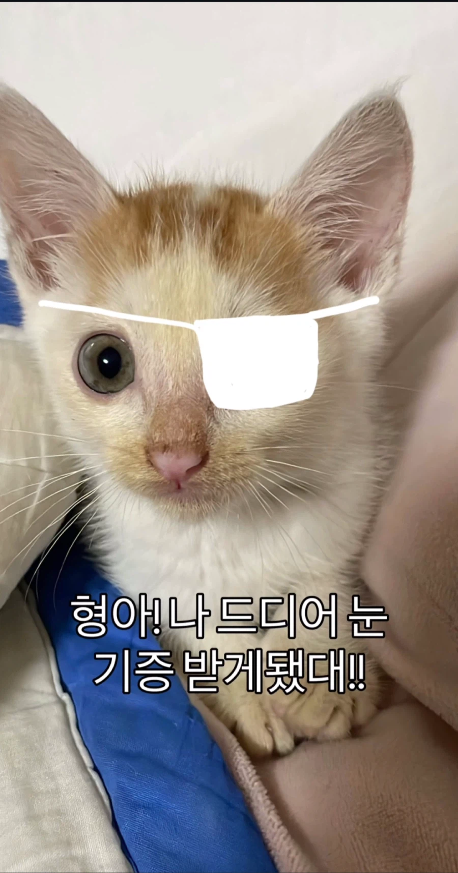 눈을 기증 받게된 애꾸 동생.jpg