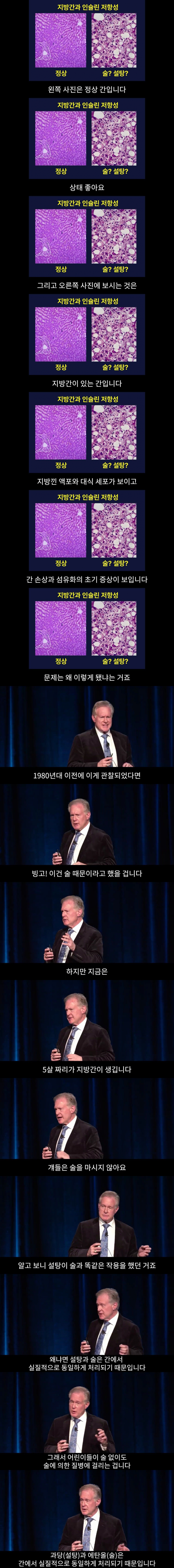 지방간 생기는 원인