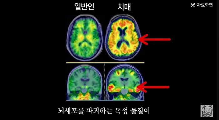 숏폼 중독이 무서운 뇌과학적 이유_25.webp