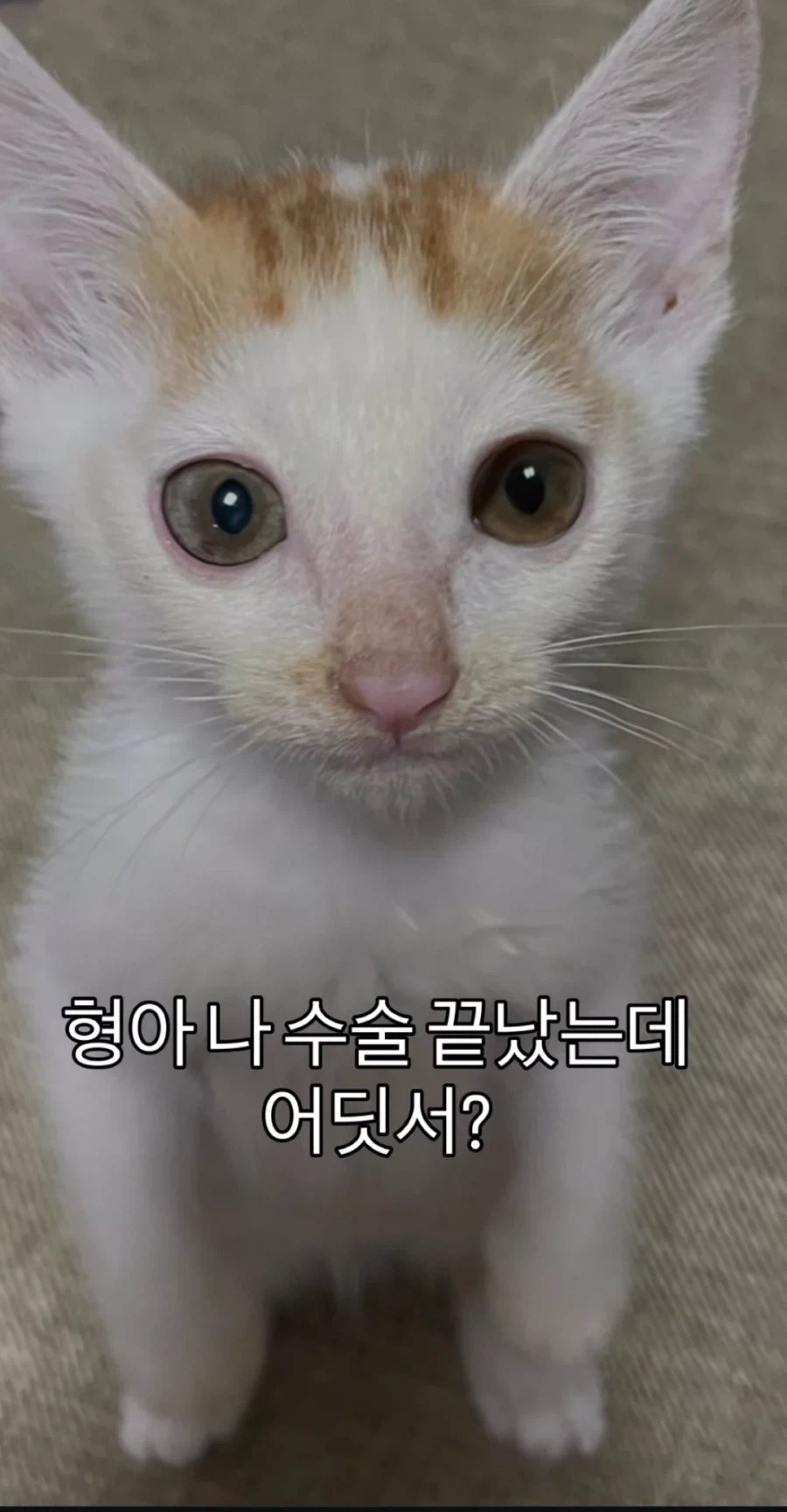 눈을 기증 받게된 애꾸 동생.jpg_6.webp