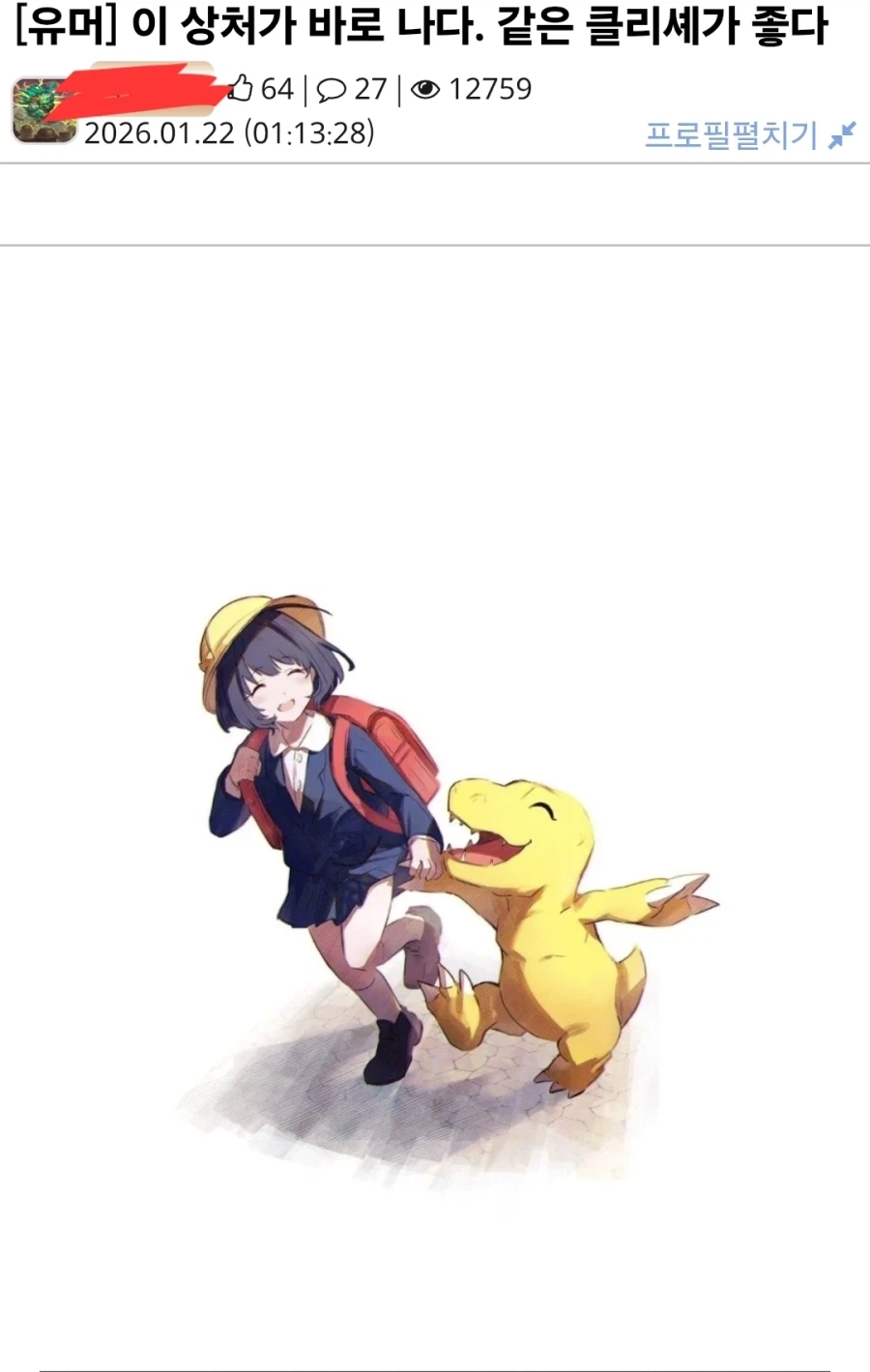 '이 상처가 나다' 같은 클리셰가 좋다.jpg_1.webp